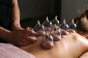 Cupping Therapy
